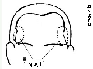 体相命理看哪些人容易有异国恋