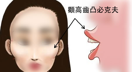 刘恒面相俗语解读：颧高齿凸必克夫吗？