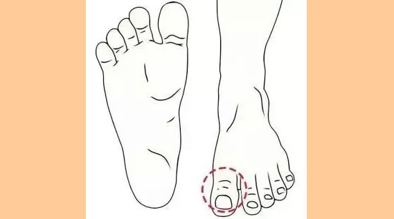 脚趾有这三大特征的人富贵多金!