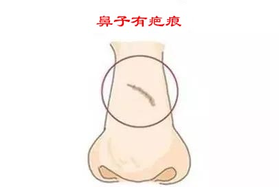 脸上哪些部位有疤会影响人的运势?