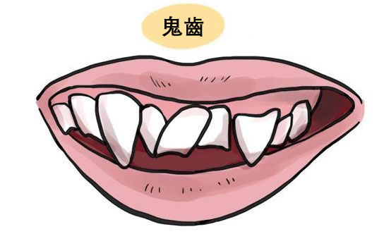 面相识人：鬼齿凸眼之人爱搬弄是非，老来无依