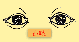 面相识人：鬼齿凸眼之人爱搬弄是非，老来无依