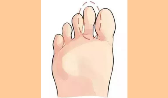 脚趾有这三大特征的人富贵多金!
