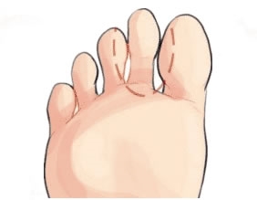 “穷人脚”“富贵足”,步步不一样,你的脚什么样就是什么命!