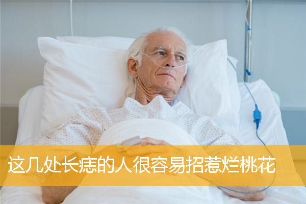 这几处长痣的人很容易招惹烂桃花