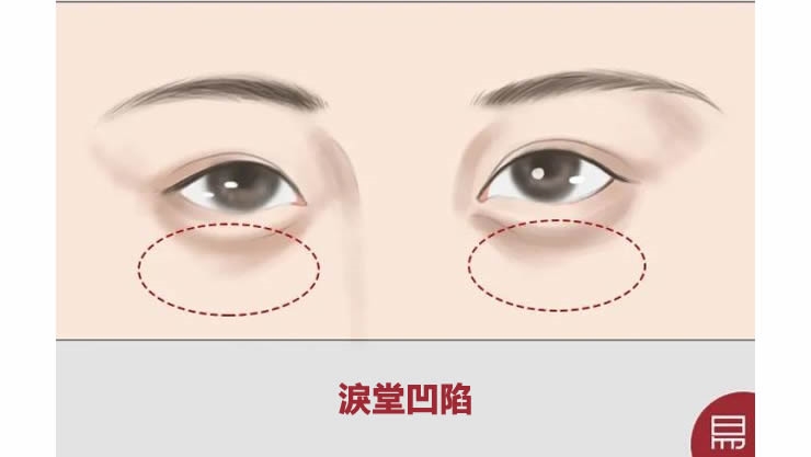 这4种情况全占,就是天生孤相!老易带你读《麻衣神相·神异赋》