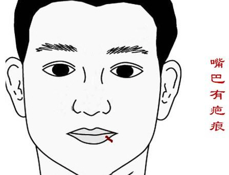 脸上哪些部位有疤会影响人的运势?