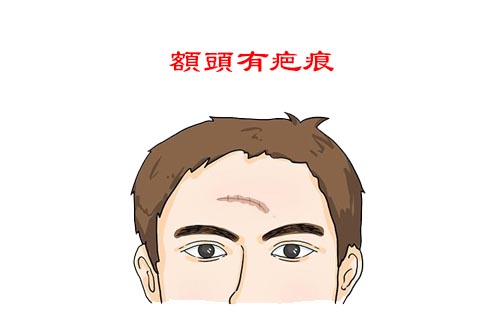 脸上哪些部位有疤会影响人的运势?