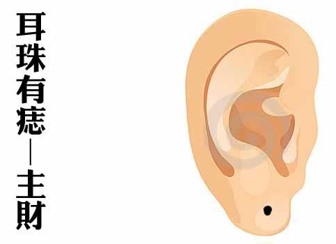 身体这几个部位长痣是福痣!一辈子有好运和富贵一生