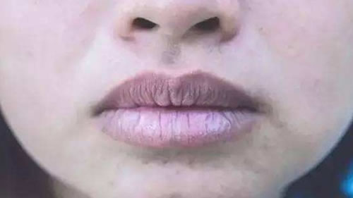 心脏好不好，看脸就知道！有这几种“长相”的人危险了！