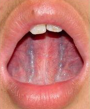 心脏好不好，看脸就知道！有这几种“长相”的人危险了！