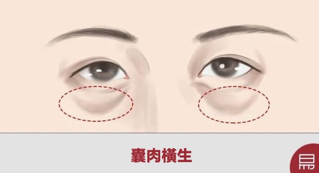 这4种情况全占,就是天生孤相!老易带你读《麻衣神相·神异赋》