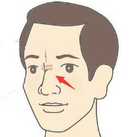 身体哪些部位不宜见到疤痕