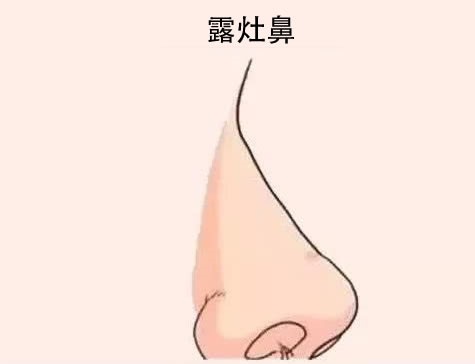 四种容易漏财的鼻相，要谨慎理财！