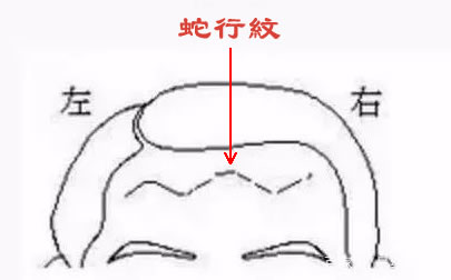 清雅居士：额头有这种纹路出现，外出要特别小心！
