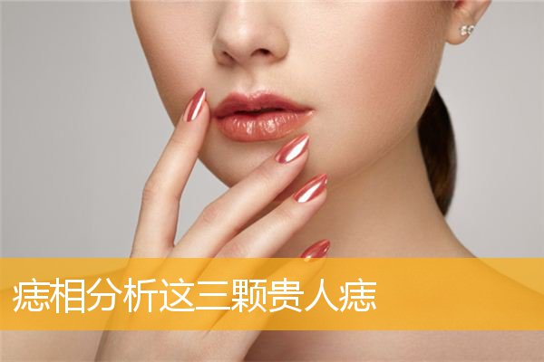 痣相分析这三颗贵人痣