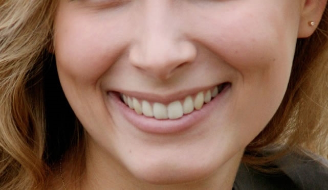 嘴角两边有皱纹代表什么？会影响运势吗？