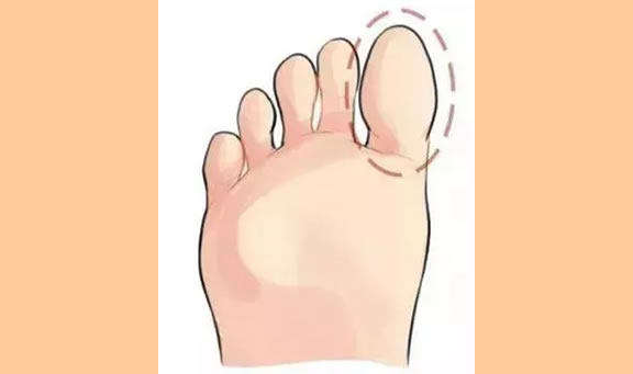 脚趾有这三大特征的人富贵多金!