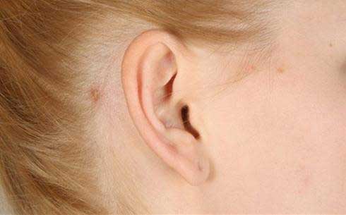 命理师：如何把耳朵细小不好的相改为好相？