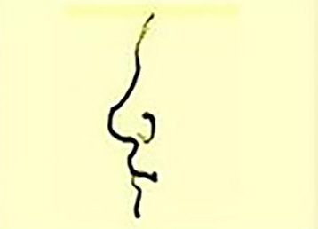 阅人三十六术之三:鼻子