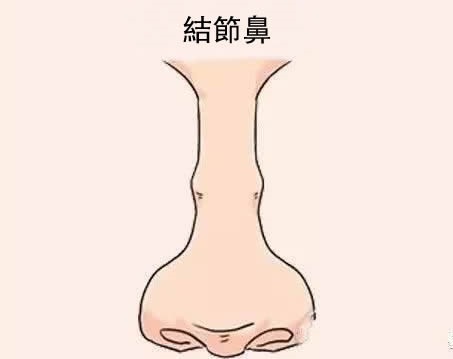 四种容易漏财的鼻相，要谨慎理财！