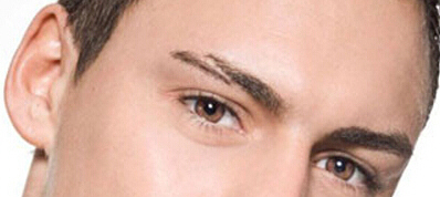 身体哪些部位不宜见到疤痕